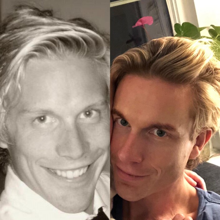 Christoffer Hernæs sine bilder fra "10 Year Challenge" -- da og nå. Christoffer Hernæs sine bilder fra "10 Year Challenge" -- da og nå.