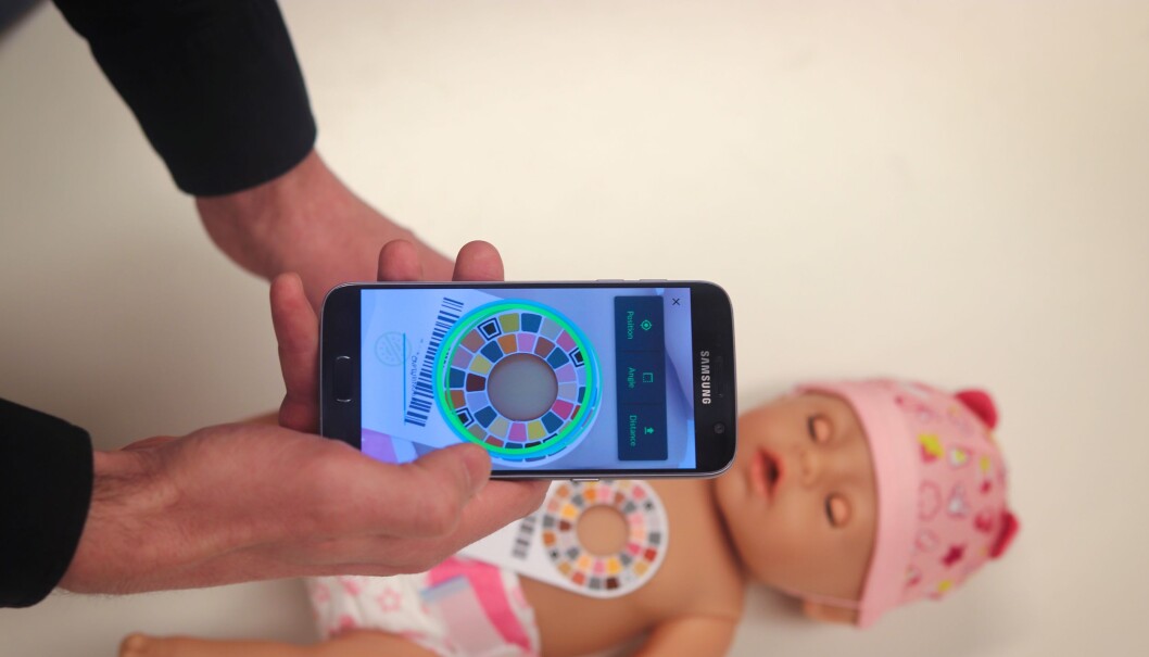 Med en app og et fargekort skal det bli lettere å oppdage gulsott Med en app og et fargekort skal det bli lettere å oppdage gulsott