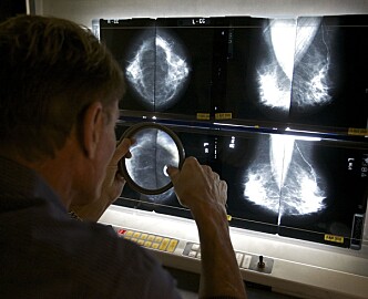 Kunstig intelligens oppdager brystkreft
